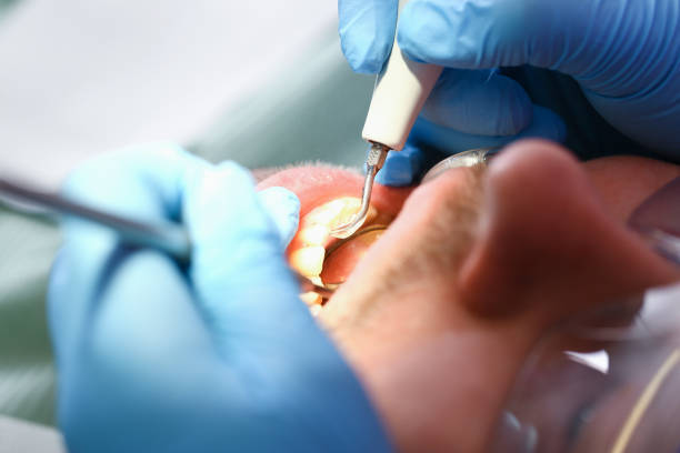 Best Emergency TMJ Treatment in Marksville, LA